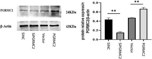 Progesterone receptor membrane component 2 regulates the neuronal activity and participates in epileptic seizures in experimental mice