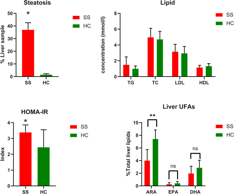 The Integrated Bioinformatic Assay of Genetic Expression Features and Analyses of Traditional Chinese Medicine Specific Constitution Reveal Metabolic Characteristics and Targets in Steatosis of Nonalcoholic Fatty Liver Disease.