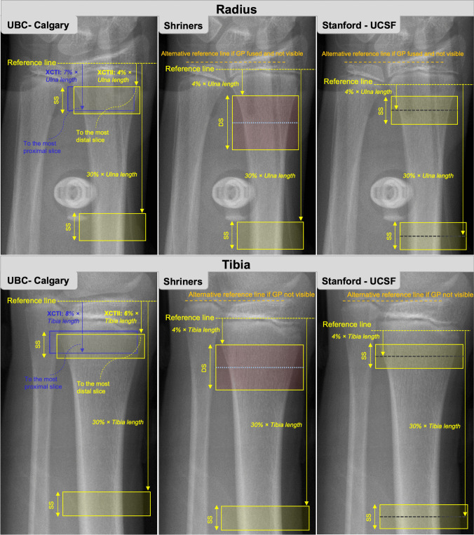 Recommendations for High-resolution Peripheral Quantitative Computed Tomography Assessment of Bone Density, Microarchitecture, and Strength in Pediatric Populations.