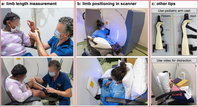 Recommendations for High-resolution Peripheral Quantitative Computed Tomography Assessment of Bone Density, Microarchitecture, and Strength in Pediatric Populations.