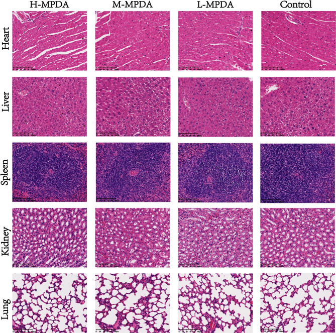 The subacute toxicity and underlying mechanisms of biomimetic mesoporous polydopamine nanoparticles.