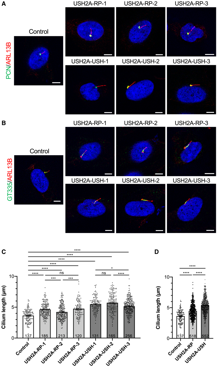 <i>USH2A</i> variants causing retinitis pigmentosa or Usher syndrome provoke differential retinal phenotypes in disease-specific organoids.