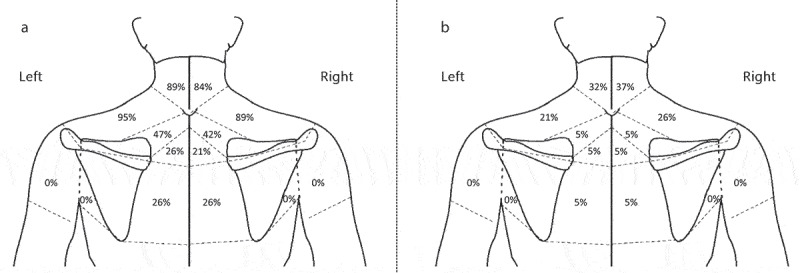 Immediate neck hypoalgesic effects of craniocervical flexion exercises and cervical retraction exercises among individuals with non-acute neck pain and a directional preference for retraction or extension: preliminary pretest-posttest randomized experimental design.