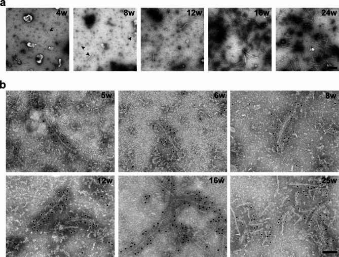 Cryo-EM structures of tau filaments from the brains of mice transgenic for human mutant P301S Tau.