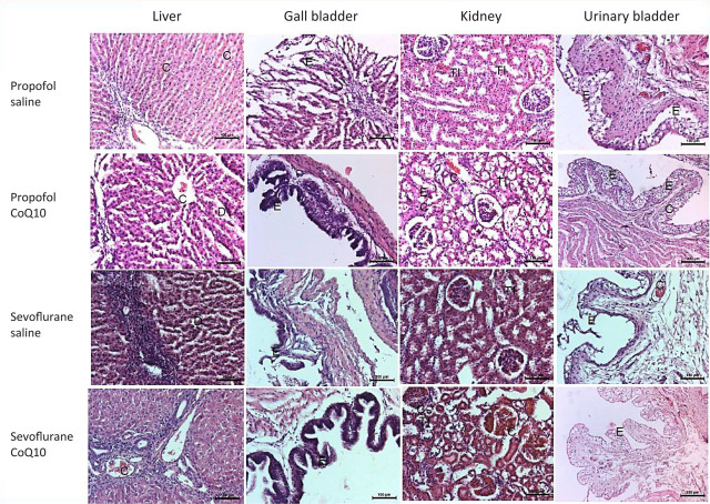 Effects of coenzyme Q10 in a propofol infusion syndrome model of rabbits.