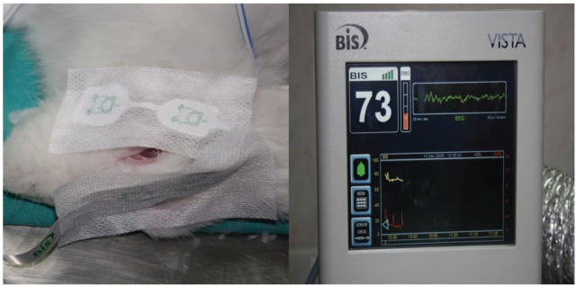 Effects of coenzyme Q10 in a propofol infusion syndrome model of rabbits.