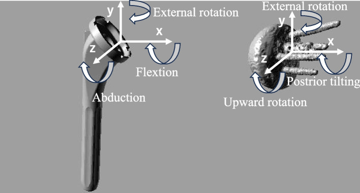 Analysis of in vivo humeral rotation of reverse total shoulder arthroplasty patients during shoulder abduction on the scapular plane with a load.