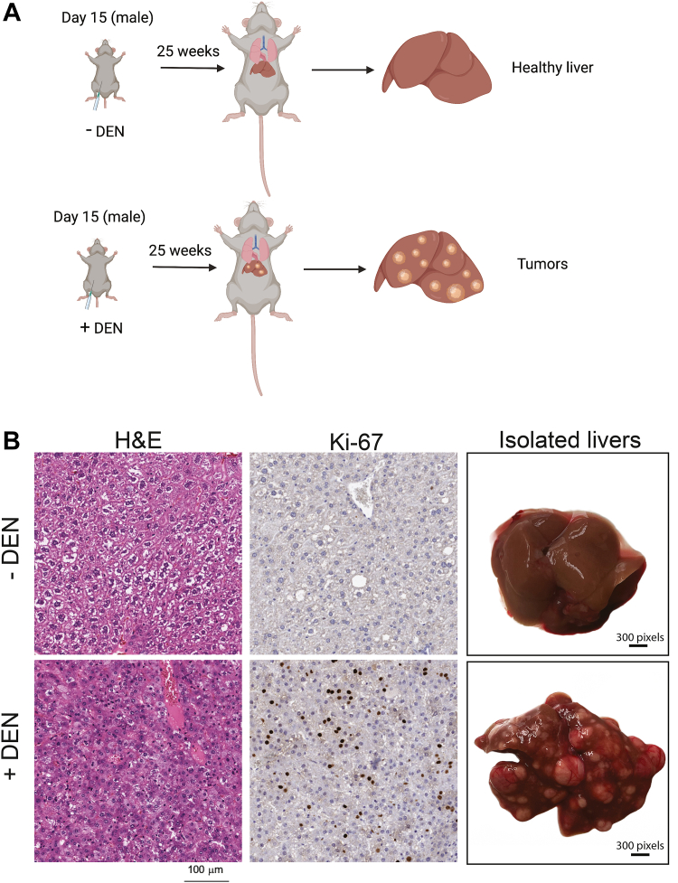 Preservation of circadian rhythm in hepatocellular cancer.