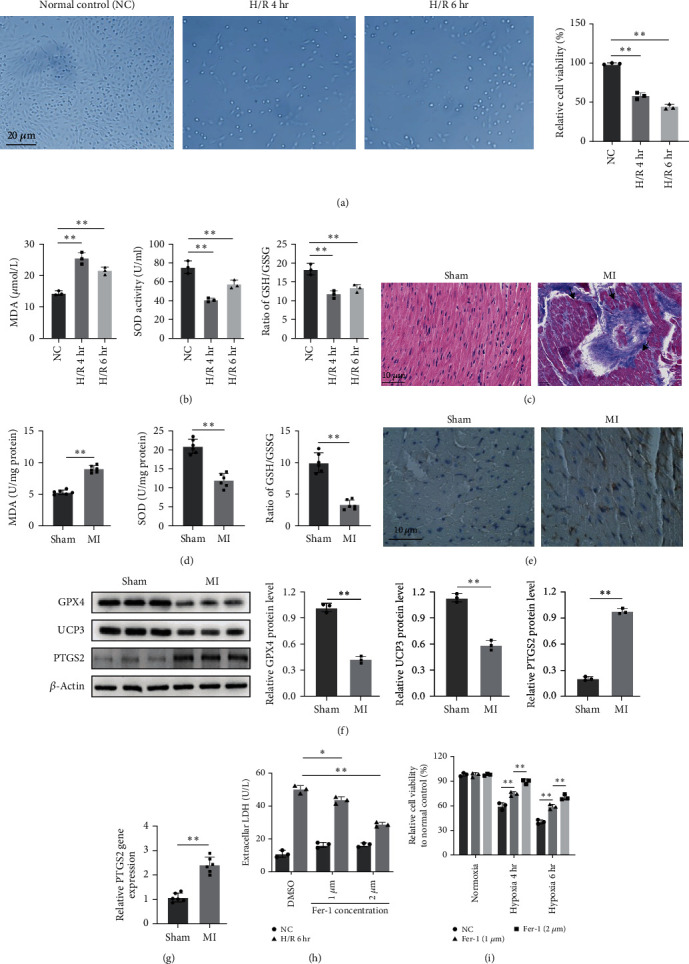 miR-432-5p Inhibits the Ferroptosis in Cardiomyocytes Induced by Hypoxia/Reoxygenation via Activating Nrf2/SLC7A11 Axis by Degrading Keap1.