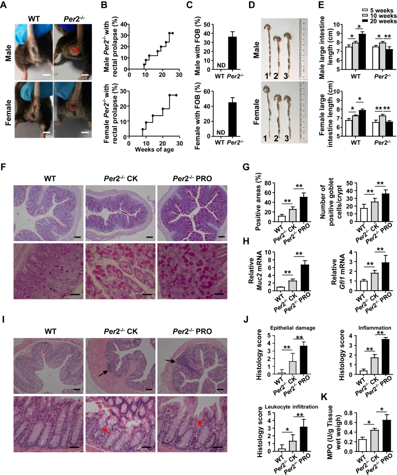 PER2/P65-driven glycogen synthase 1 transcription in macrophages modulates gut inflammation and pathogenesis of rectal prolapse.