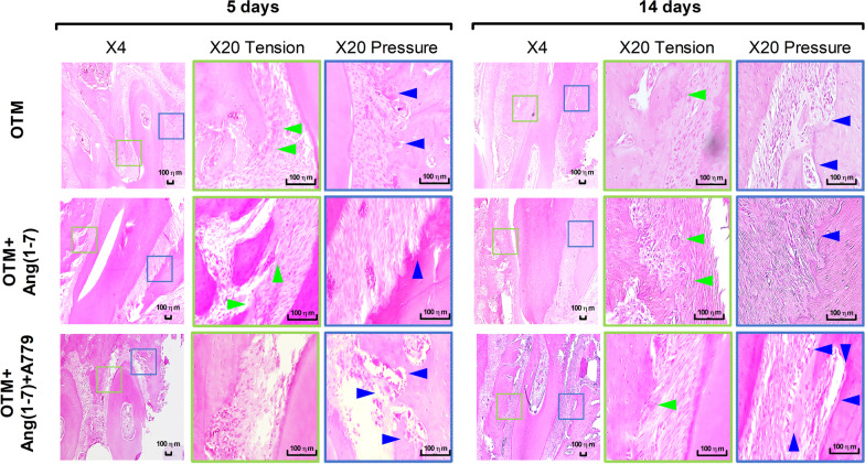 Angiotensin(1-7) attenuates tooth movement and regulates alveolar bone response during orthodontic force application in experimental animal model.