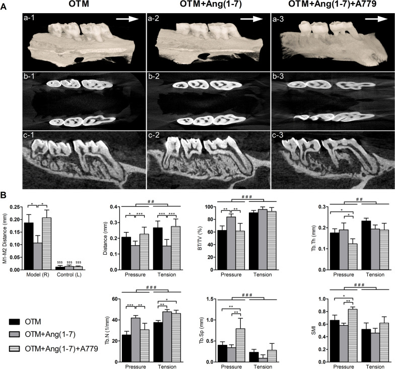 Angiotensin(1-7) attenuates tooth movement and regulates alveolar bone response during orthodontic force application in experimental animal model.