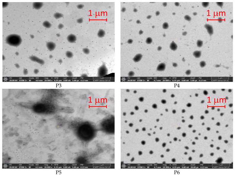 Development of Solid Lipid Nanoparticles for Controlled Amiodarone Delivery.