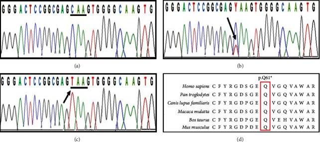 A Recurrent Nonsense Mutation in NECTIN4 Underlying Ectodermal Dysplasia-Syndactyly Syndrome with a Novel Phenotype in a Consanguineous Kashmiri Family.