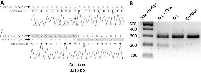 Rare PMP22 variants in mild to severe neuropathy uncorrelated to plasma GDF15 or neurofilament light.