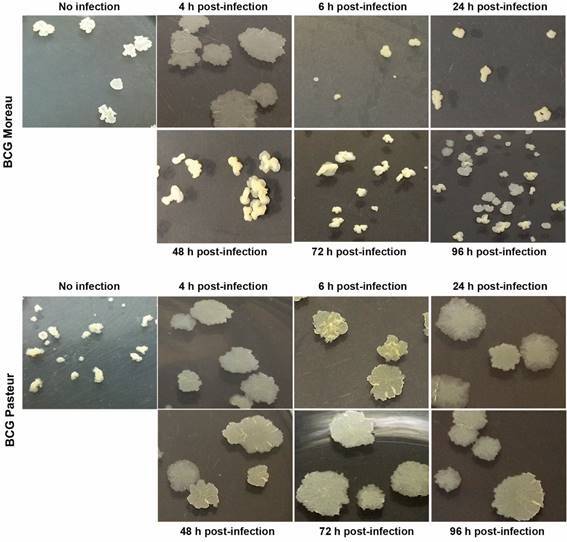 Differences in responses to the intracellular macrophage environment between Mycobacterium bovis BCG vaccine strains Moreau and Pasteur.