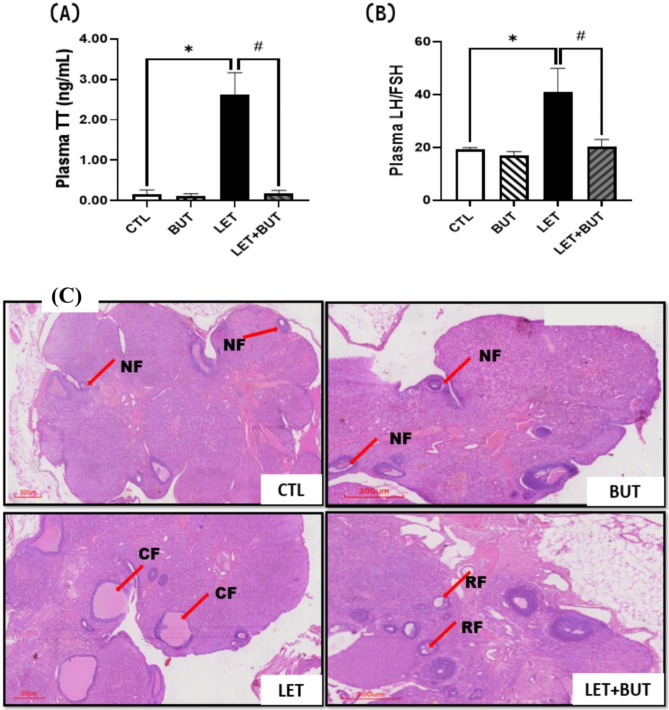 Butyrate alleviates renal inflammation and fibrosis in a rat model of polycystic ovarian syndrome by suppression of SDF-1.