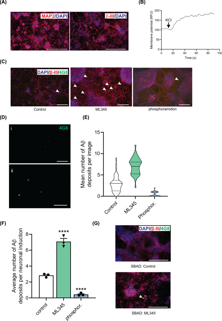 Inhibition of insulin-degrading enzyme in human neurons promotes amyloid-β deposition.