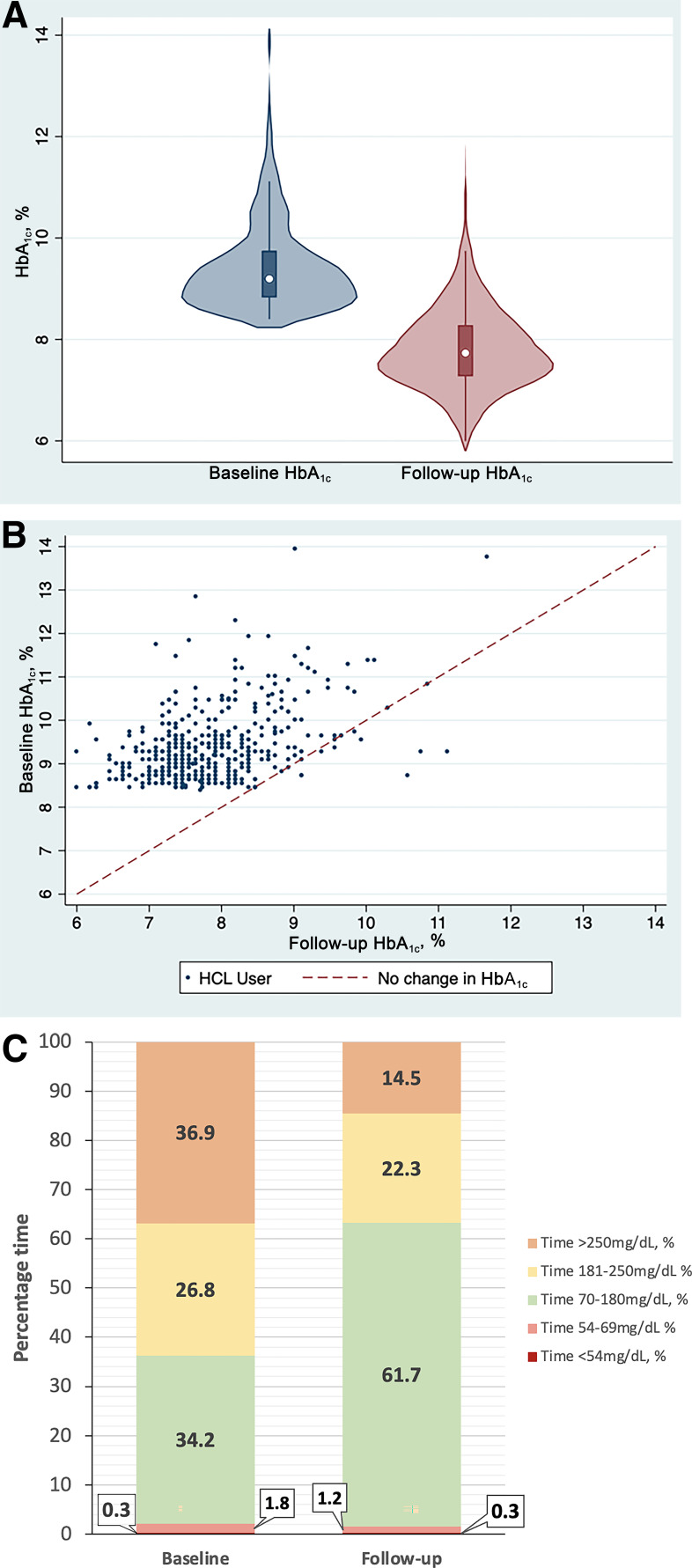 Hybrid Closed-Loop Therapy in Adults With Type 1 Diabetes and Above-Target HbA1c: A Real-world Observational Study.