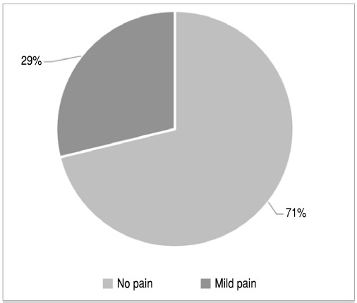 OSTEOSYNTHESIS OF A SCAPHOID NECK FRACTURE WITH A CANNULATED COMPRESSION SCREW: EVALUATION OF 52 PATIENTS.