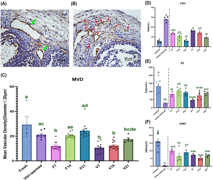 Adverse effects of ovarian cryopreservation and auto-transplantation on ovarian grafts and quality of produced oocytes in a mouse model.