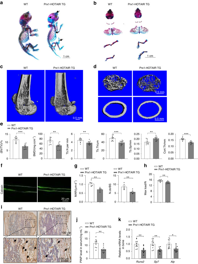 HuR-mediated nucleocytoplasmic translocation of HOTAIR relieves its inhibition of osteogenic differentiation and promotes bone formation.