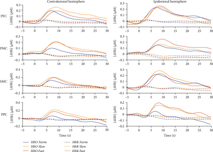 Premotor and Posterior Parietal Cortex Activity is Increased for Slow, as well as Fast Walking Poststroke: An fNIRS Study.