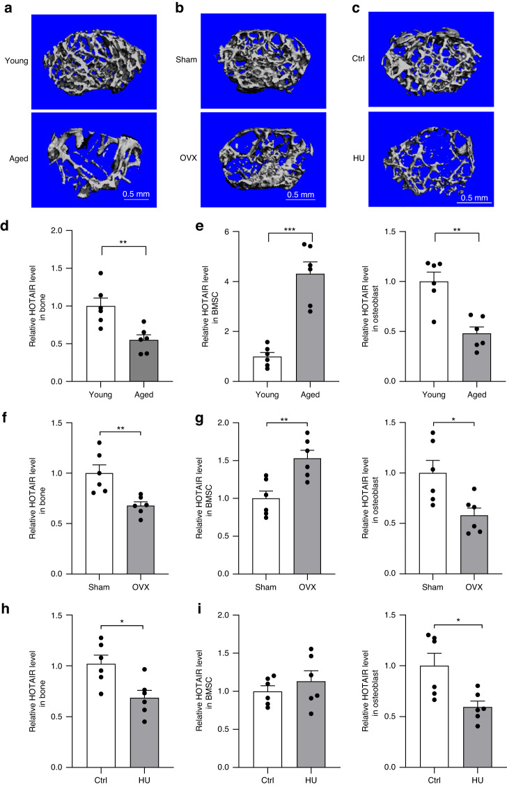 HuR-mediated nucleocytoplasmic translocation of HOTAIR relieves its inhibition of osteogenic differentiation and promotes bone formation.