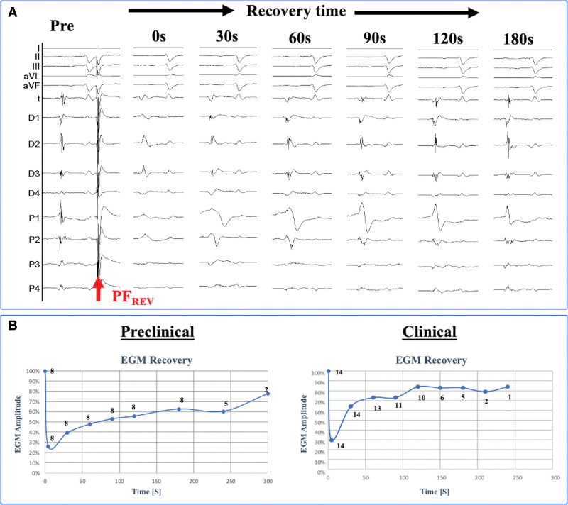 Reversible Pulsed Electrical Fields as an In Vivo Tool to Study Cardiac Electrophysiology: The Advent of Pulsed Field Mapping.