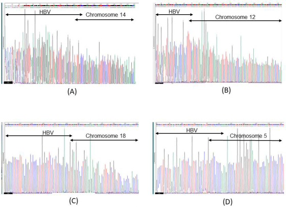 Integration of Viral Genome to Human Genomic DNA in Nails of Patients with Chronic Hepatitis B Virus Infection.