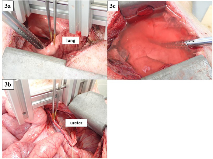 Development of Medical Shark Skin Forceps: Improved Grasping Power and Easy Manipulation.