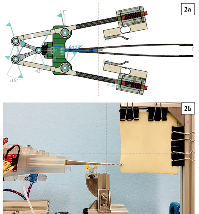 Development of Medical Shark Skin Forceps: Improved Grasping Power and Easy Manipulation.