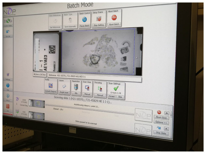 Eye for an AI: More-than-seeing, fauxtomation, and the enactment of uncertain data in digital pathology.