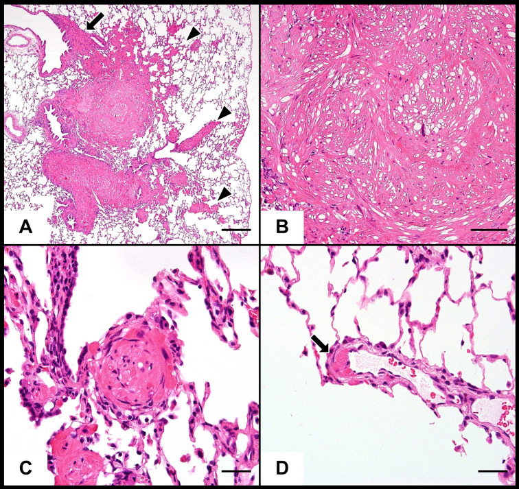 Smooth muscle hamartoma of the lungs in a Wistar Hannover rat.