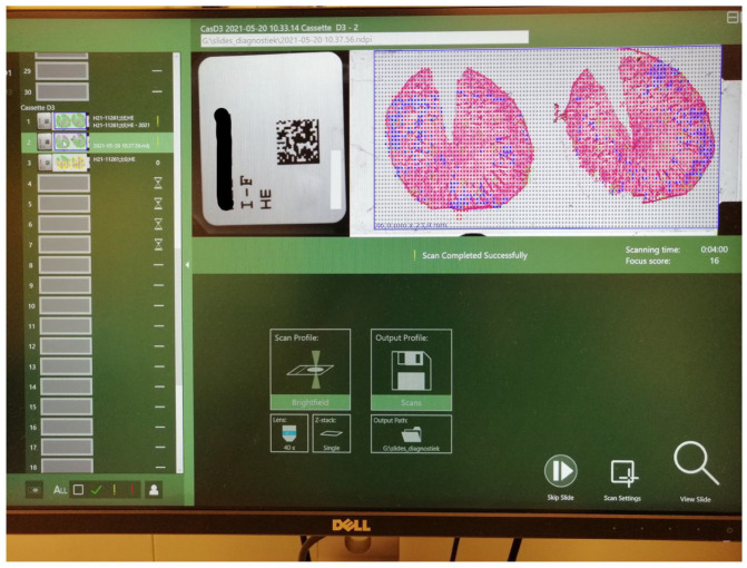 Eye for an AI: More-than-seeing, fauxtomation, and the enactment of uncertain data in digital pathology.