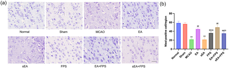 Electroacupuncture inhibits the expression of HMGB1/RAGE and alleviates injury to the primary motor cortex in rats with cerebral ischemia.