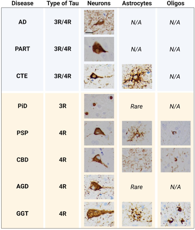 Determinants of astrocytic pathology in stem cell models of primary tauopathies.