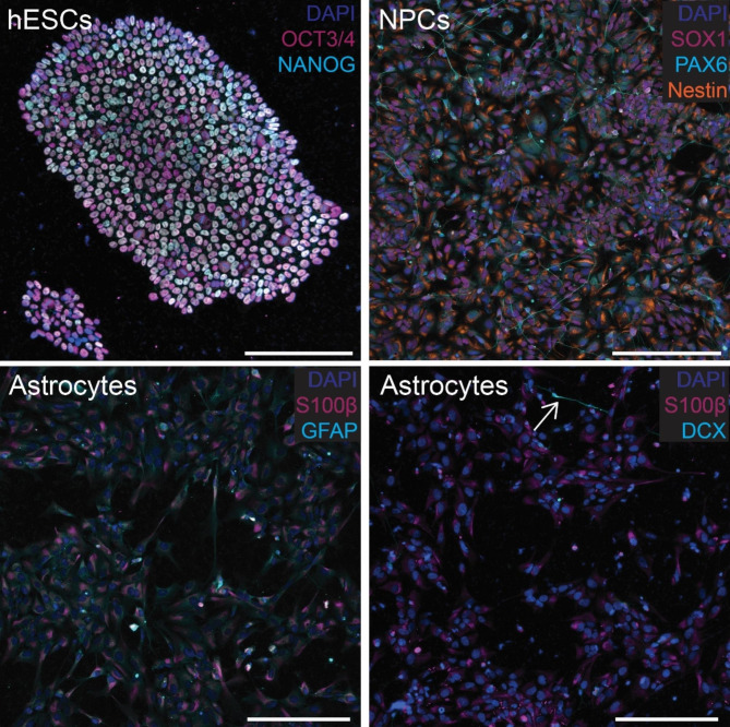 Determinants of astrocytic pathology in stem cell models of primary tauopathies.