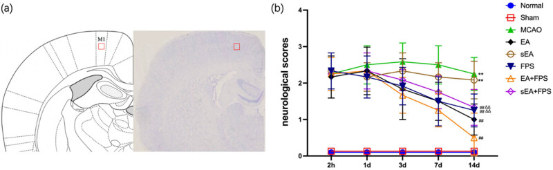 Electroacupuncture inhibits the expression of HMGB1/RAGE and alleviates injury to the primary motor cortex in rats with cerebral ischemia.