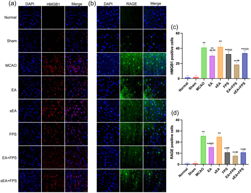 Electroacupuncture inhibits the expression of HMGB1/RAGE and alleviates injury to the primary motor cortex in rats with cerebral ischemia.