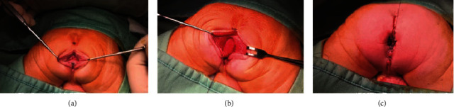 Anorectal Malformations: The Pivotal Role of the Good Clinical Practice.