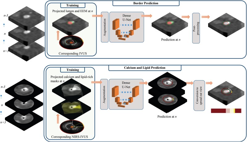 Novel near-infrared spectroscopy-intravascular ultrasound-based deep-learning methodology for accurate coronary computed tomography plaque quantification and characterization.