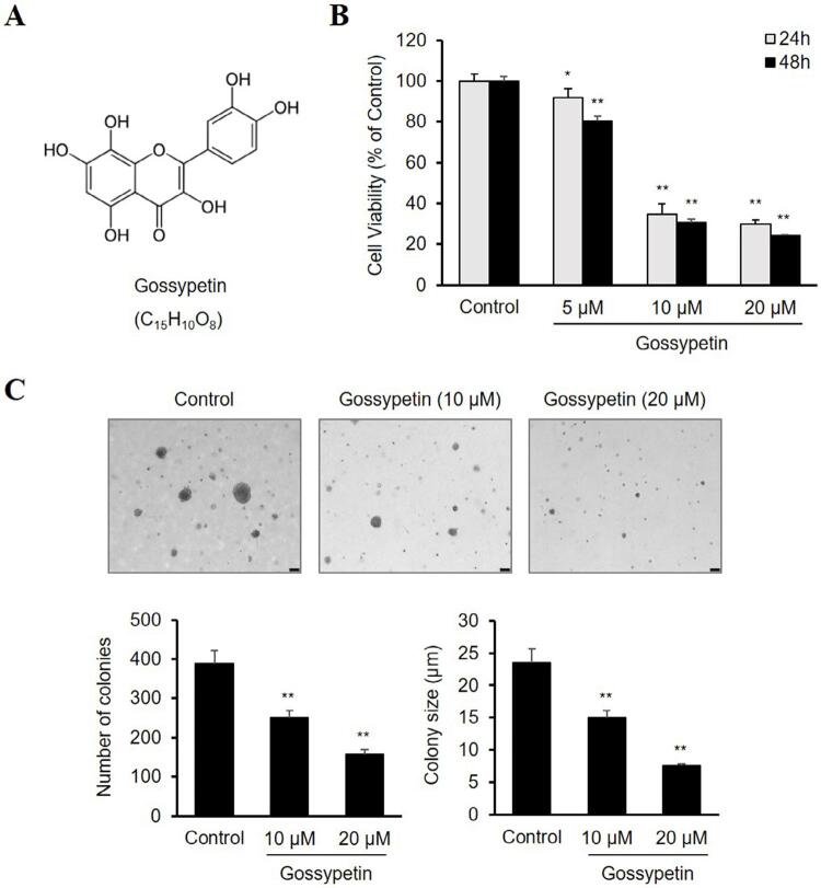 Anticancer effects of gossypetin from Hibiscus sabdariffa in oral squamous cell carcinoma.