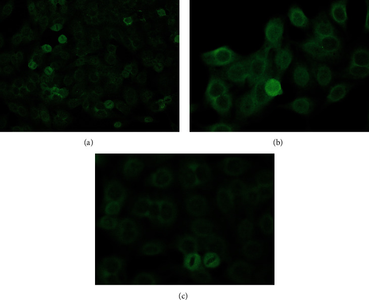 The Discrepancy of ANA and Compartment Bead Patterns Suggestive of a Neuropsychiatry Systemic Lupus Erythematosus (NPSLE).