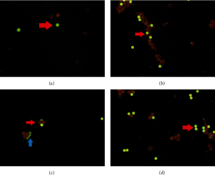 The Discrepancy of ANA and Compartment Bead Patterns Suggestive of a Neuropsychiatry Systemic Lupus Erythematosus (NPSLE).