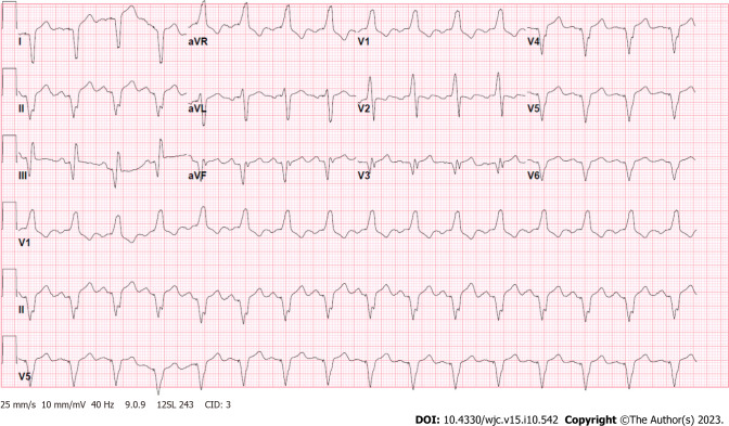 Systemic right ventricle complications in levo-transposition of the great arteries: A case report and review of literature.