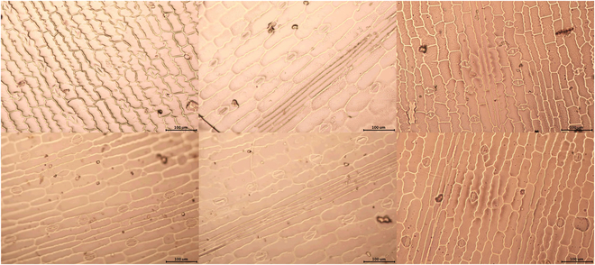 Rotating Stomata Measurement Based on Anchor-Free Object Detection and Stomata Conductance Calculation.