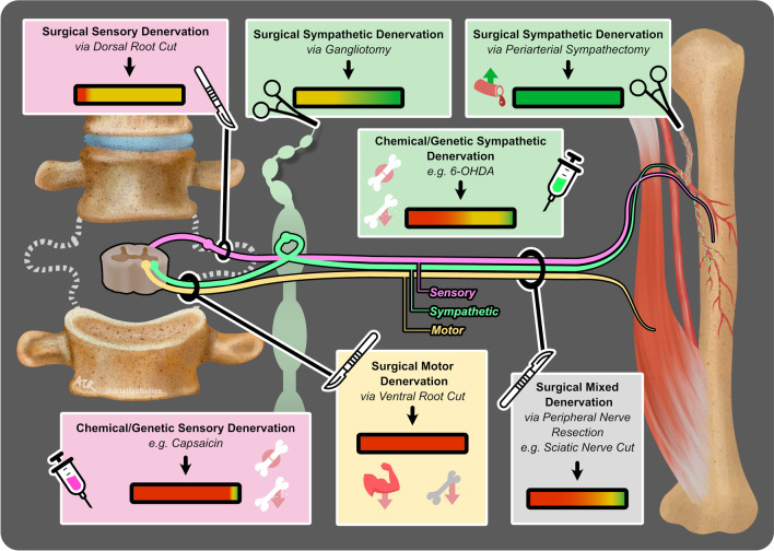 Role of the Peripheral Nervous System in Skeletal Development and Regeneration: Controversies and Clinical Implications.