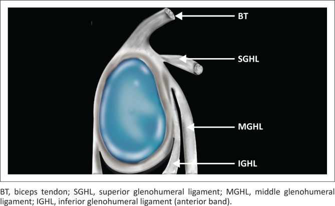 Superior labrum anterior to posterior lesions: Part 1 - Imaging and anatomy with arthroscopic classification.