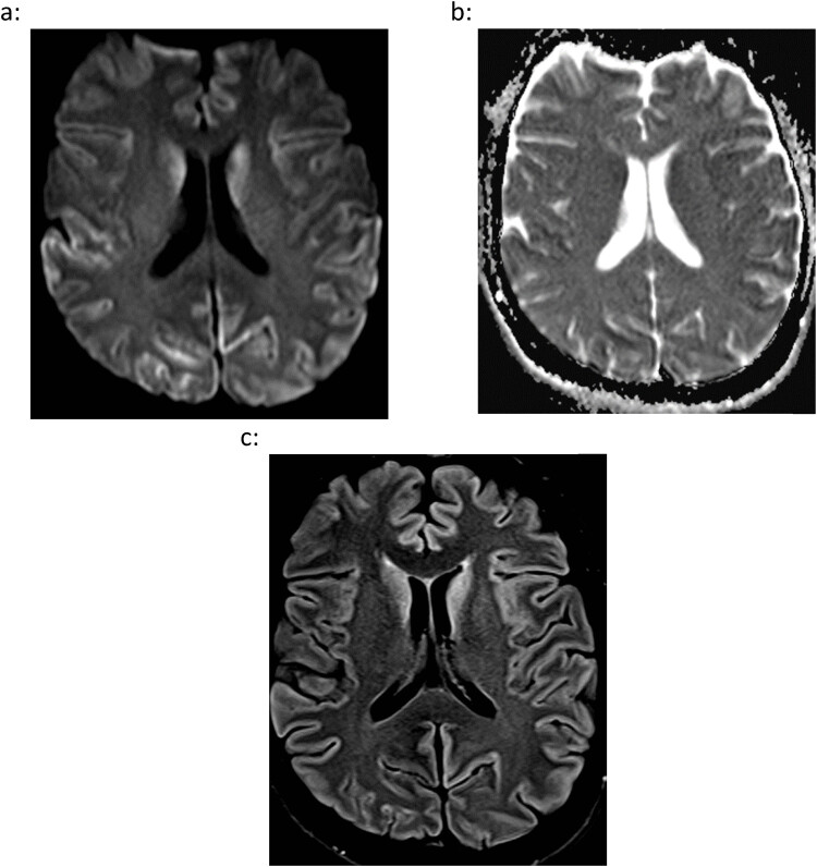 Human prion diseases and the prion protein - what is the current state of knowledge?